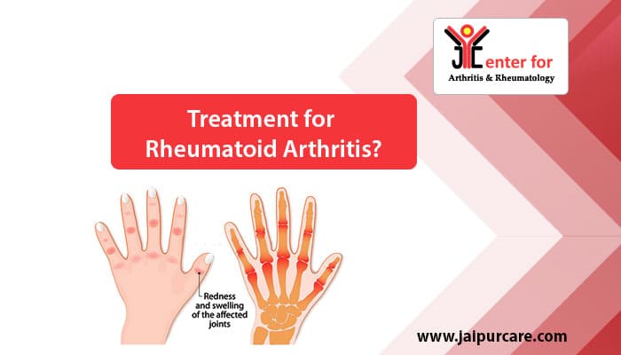 treatment of rheumatoid arthritis