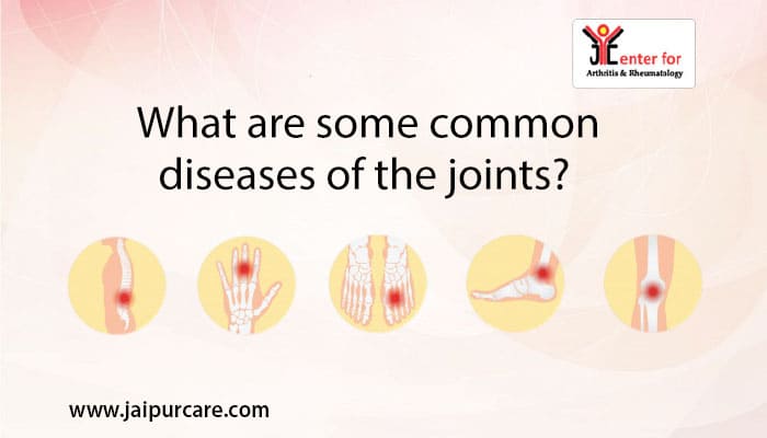 What are some common diseases of joints?