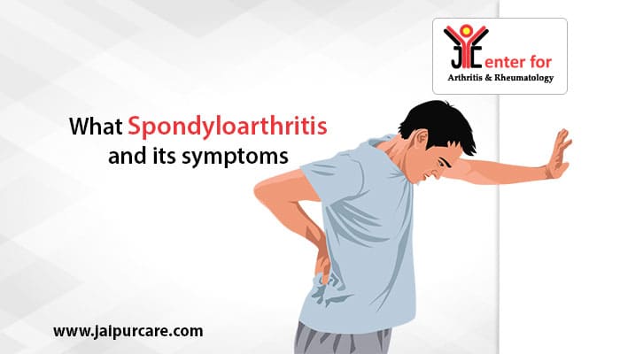 What Is Spondyloarthritis And Its Symptoms?