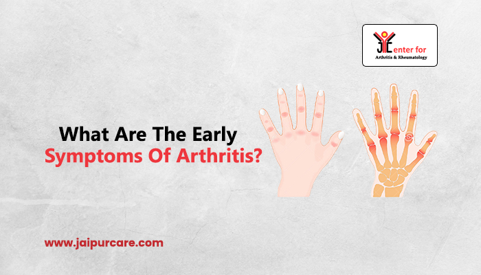 Symptoms Of Arthritis