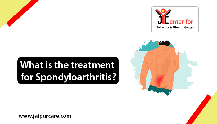 treatment for spondyloarthritis