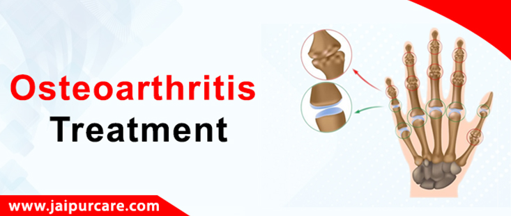 Osteoarthritis Treatment in Jaipur