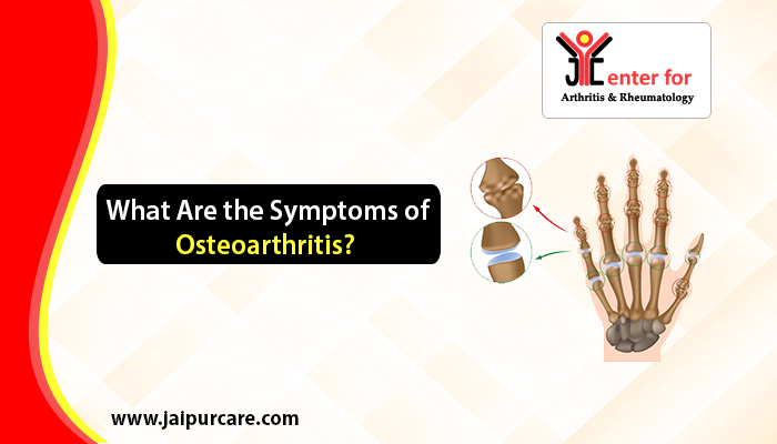 Symptoms of Osteoarthritis