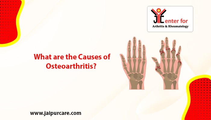 causes of osteoarthritis