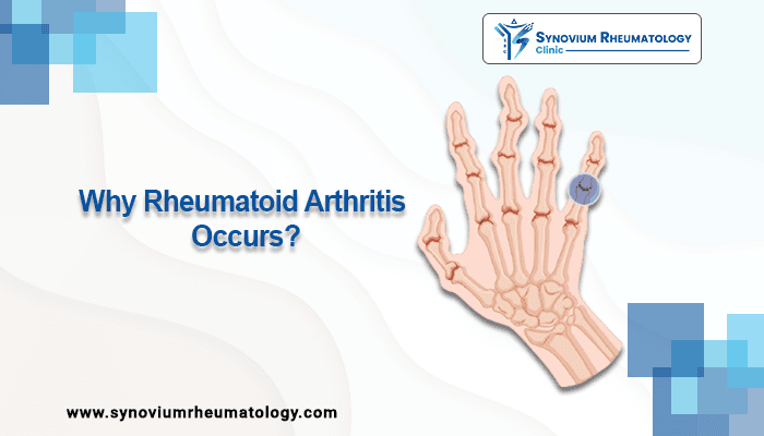 Why Rheumatoid Arthritis occurs