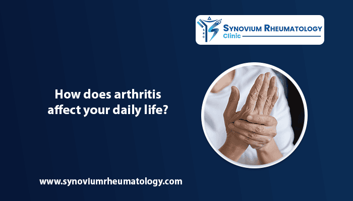 How does arthritis affect your daily life