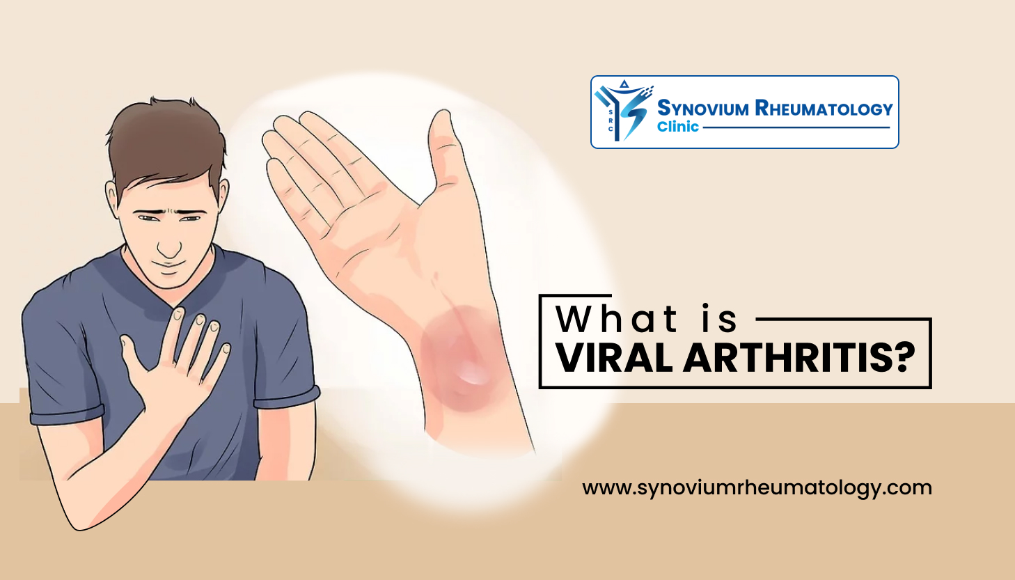 What is Viral Arthritis