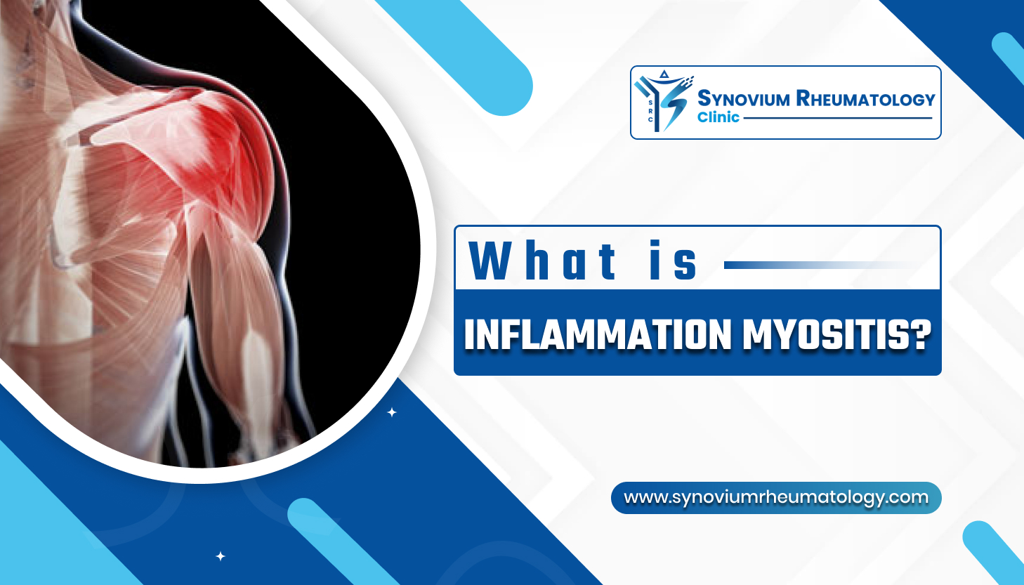 What is inflammation Myositis